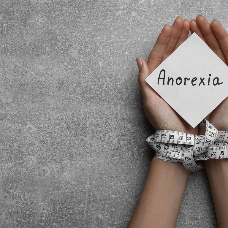 10ff4bc3-ANOREXIA
